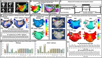 Ablation and antiarrhythmic drug effects on PITX2+/− deficient atrial fibrillation: A computational modeling study